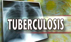 Cuba Observes World Tuberculosis Day